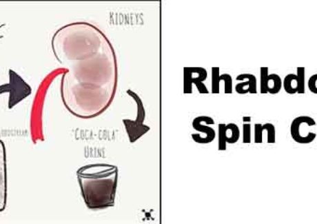 Rhabdo spin class